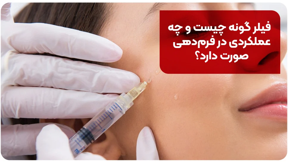 فیلر گونه چیست و چه عملکردی در فرمدهی صورت دارد؟